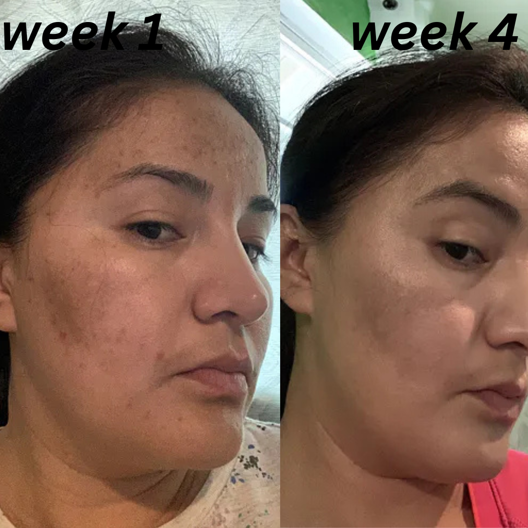 Evera Dark Spots Cream