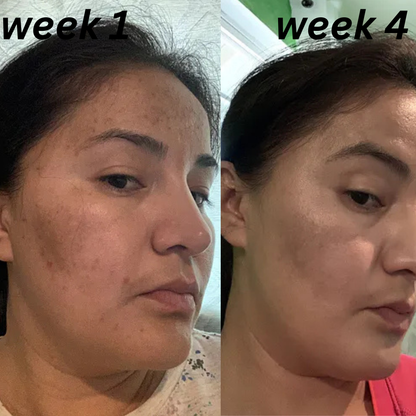 Evera Dark Spots Cream